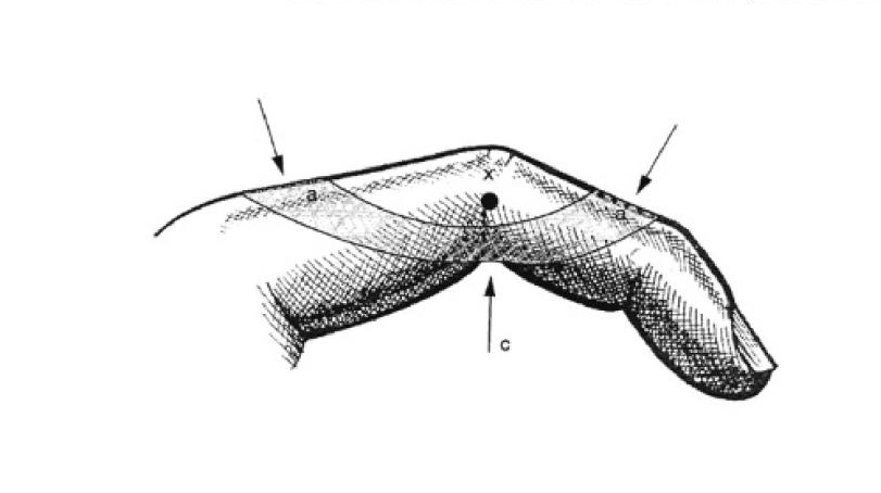 Thumbnail Image 1